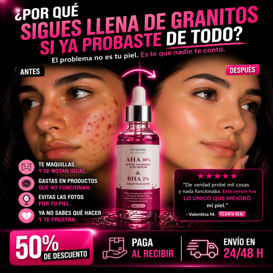 El acné que siempre vuelve… acá esta la solución