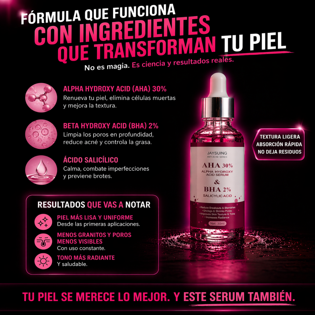 El acné que siempre vuelve… acá esta la solución