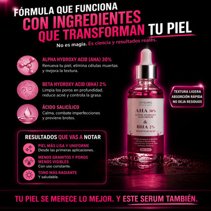 El acné que siempre vuelve… acá esta la solución